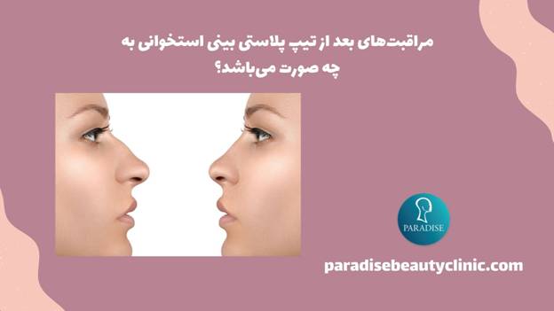مراقبتهای بعد از تیپ پلاستی بینی استخوانی به چه صورت میباشد؟